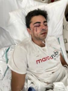 breaking news miami, miami news today, Former Hialeah City Council Candidate Christopher Monzon was attacked in Hialeah while election-canvassing for Gov Ron DeSantis marco rubio